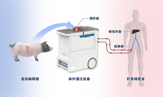 中科奥格助力湘雅二医院猪-猴原位肝移植存活时间创新纪录